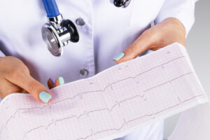 Prevenzione cardiovascolare ecg